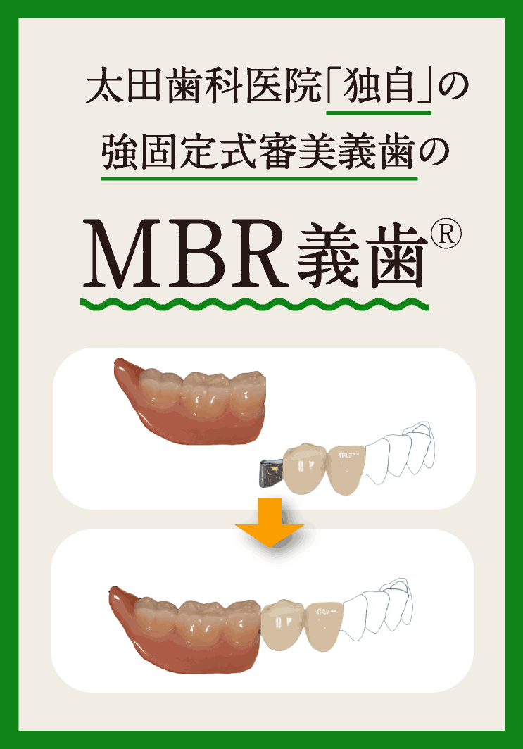 MBR