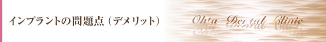 インプラントの問題点（デメリット）