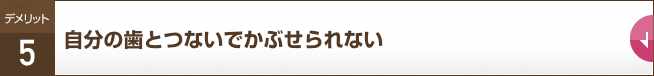 自分の歯とつないでかぶせられない