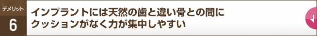 インプラントには天然の歯と違い骨との間にクッションがなく力が集中しやすい