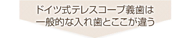 ドイツ式テレスコープ義歯は一般的な入れ歯とここが違う！