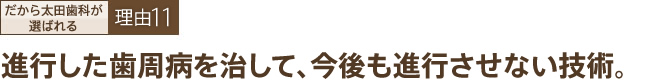 進行した歯周病を治して、今後も進行させない技術