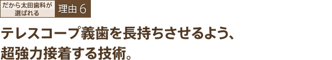 テレスコープ義歯を長持ちさせるよう、超強力接着する技術。