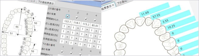 入れ歯を検討してるんだけど入れ歯だと気づかれたくない！