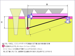 ルーペを使った精密治療が行えます。